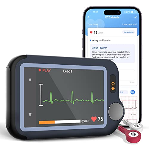CheckMe EKG Gerät für Zuhause Deutsch, 30s/60s/5min Multi-Messung Langzeit-EKG-Monitor, Bluetooth Smartphone App, Dual-User-Unterstützung, Mobiles EKG Gerät für PC-Software und Mac App von CheckMe