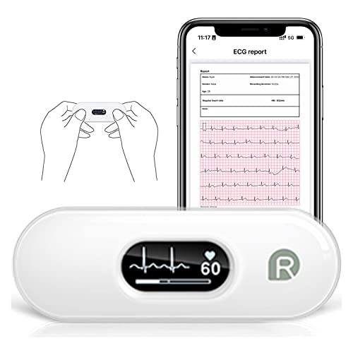 Wellue DuoEK-S Mobiles EKG Gerät, Bluetooth Wireless Tragbarer Herzmonitor mit 0,96 Zoll OLED-Bildschirm, 30s - 5 Min Überwachung, Herzfrequenzmonitor, APP für iOS und Android von Wellue