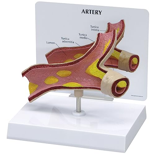 GPI Anatomicals 2600 Arterie Modell von 3B Scientific