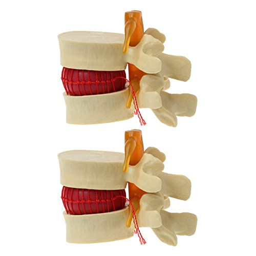 Happlignly 2X Lenden Wirbel Modell Anatomische Wirbel Säule Lenden Wirbel Scheiben Vorfall Anatomie Lehrmittel Lenden Wirbel Modell von Happlignly