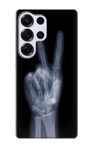 X-ray Peace Sign Fingers Hülle Schutzhülle Taschen für Samsung Galaxy S25 Ultra von Innovedesire